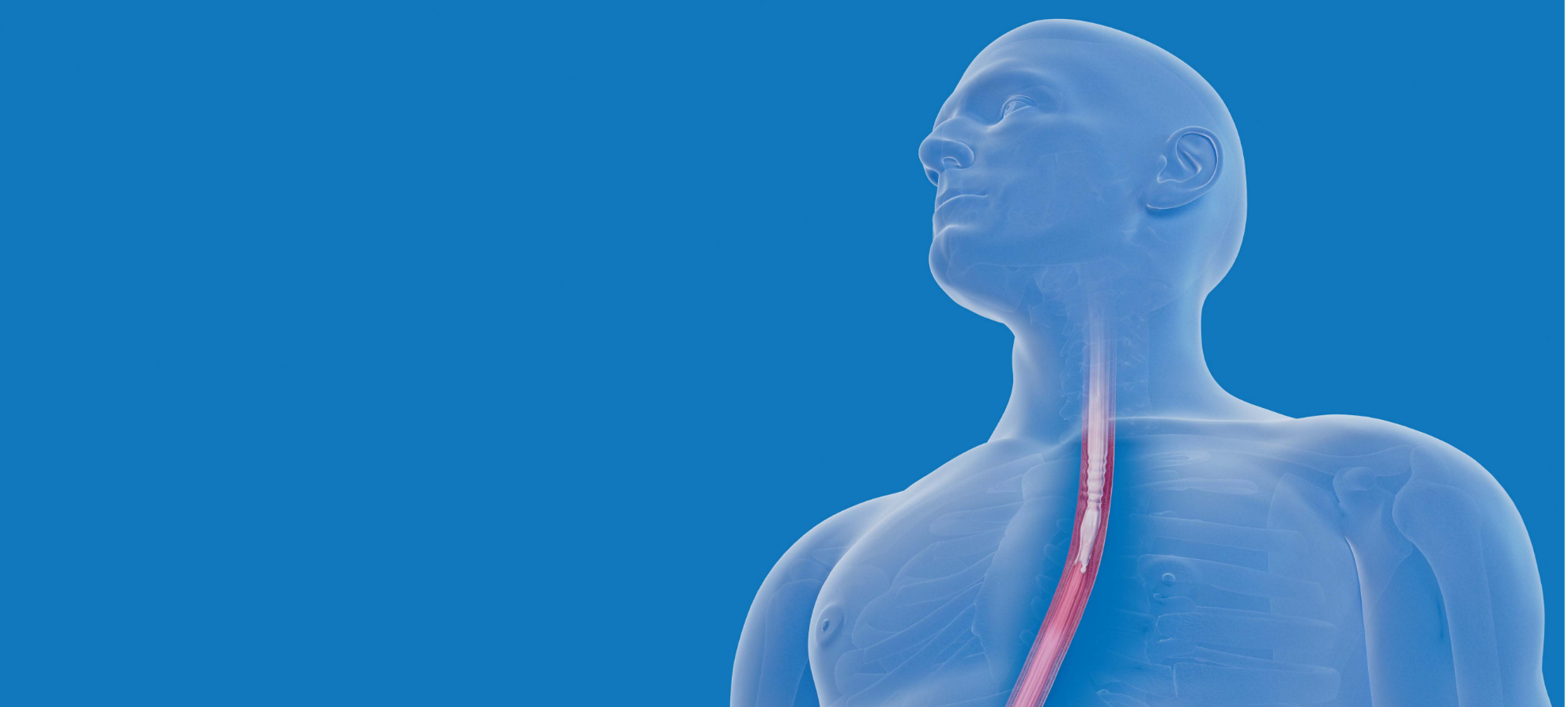 Illustration of esophageal inflammation